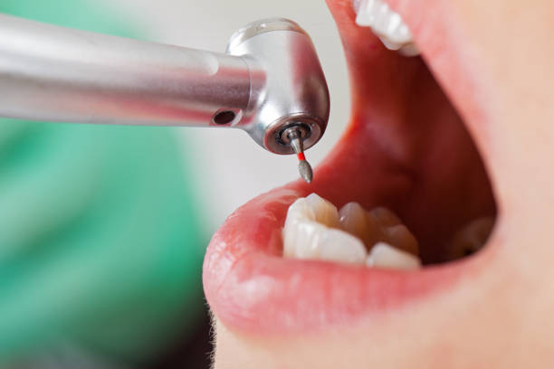 Best Emergency Treatment for Oral Infections in Spanish Fork, UT
